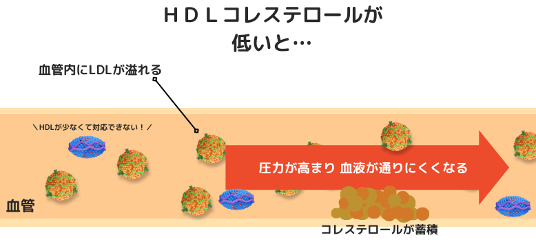 HDLコレステロールが低いことでの問題点